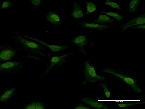 Anti-PPP2CB antibody produced in mouse