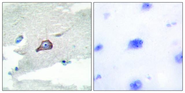Anti-HCK antibody produced in rabbit