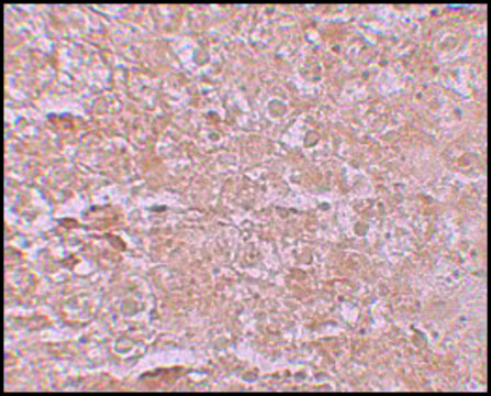 Anti-ZIP14 antibody produced in rabbit