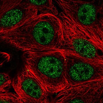 Anti-PCNX1 antibody produced in rabbit