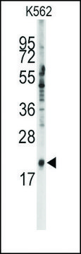 Anti-SNRPC (C-term) antibody produced in