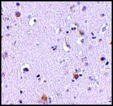 Anti-NUP160 antibody produced in rabbit