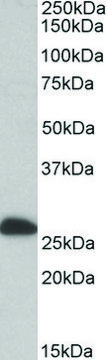 Anti-ETFB antibody produced in goat