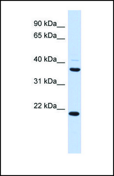 Anti-TMEM74 antibody produced in rabbit