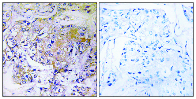 Anti-ULK3 antibody produced in rabbit