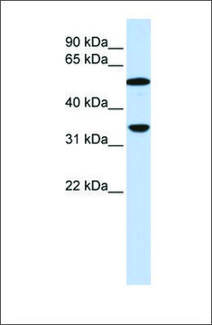 Anti-C4B antibody produced in rabbit