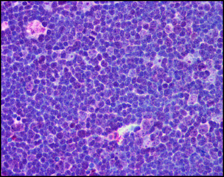 Anti-IL31 (AB2) antibody produced in