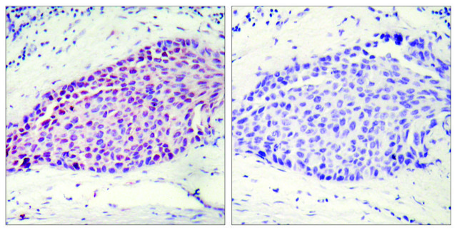 Anti-ATF2 antibody produced in rabbit