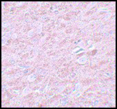 Anti-PRDM16 antibody produced in rabbit