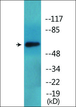 Anti-phospho-ICAM-1 (pTyr?¹²) antibody produced in