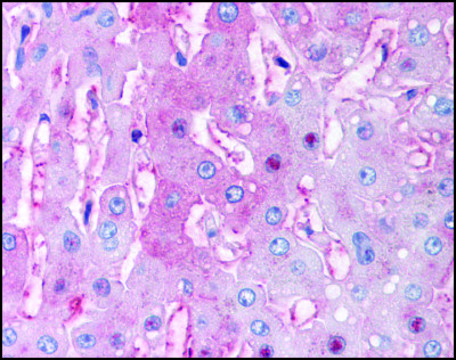 Anti-DUSP26 (AB2) antibody produced in