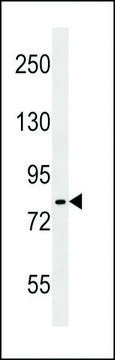 ANTI-IKK ALPHA/IKK BETA (CENTER) antibody