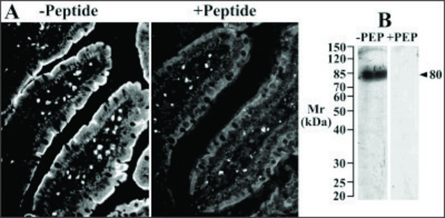 Anti-Slc5a1 antibody produced in goat