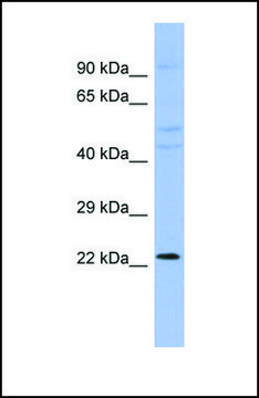Anti-CBX1, (N-terminal) antibody produced in