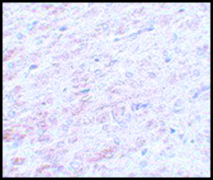 Anti-TCF3 antibody produced in rabbit