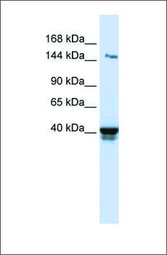 Anti-IGSF9 antibody produced in rabbit