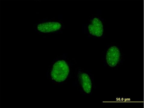 ANTI-ATOH1 antibody produced in mouse