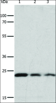 Anti-RAS antibody produced in rabbit