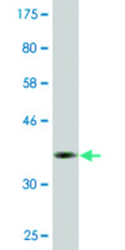 Monoclonal Anti-DBF4B antibody produced in