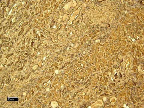 Anti-GPX3 antibody produced in goat