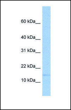 Anti-TRAPPC2 antibody produced in rabbit