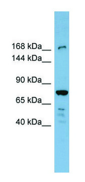 Anti-DAPK1 (N-terminal) antibody produced in
