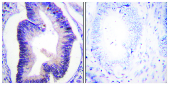 Anti-Fructose 6 Phosphate Kinase antibody