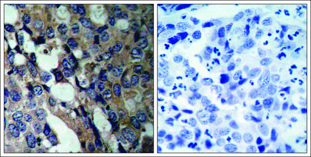 Anti-HSPB1 (Ab-15) antibody produced in