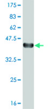 ANTI-TGIF2 antibody produced in mouse