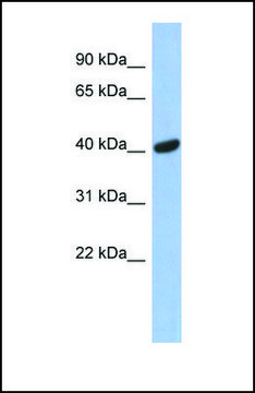 Anti-SIAH2 antibody produced in rabbit