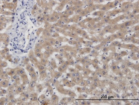 Monoclonal Anti-CBS, (N-terminal) antibody produced
