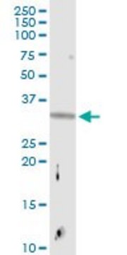 Anti-EMX2 antibody produced in rabbit