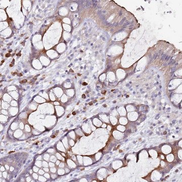Anti-STYK1 antibody produced in rabbit
