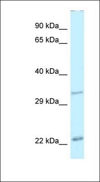 Anti-PDX1 antibody produced in rabbit