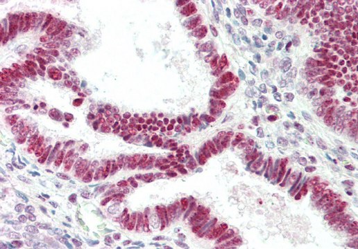 Anti-RNASEH1 antibody produced in rabbit