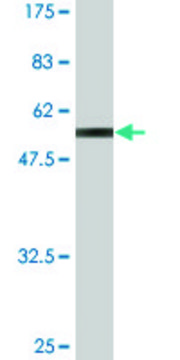 Monoclonal Anti-ZNF511, (C-terminal) antibody produced