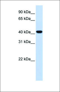 Anti-FOXD1 antibody produced in rabbit