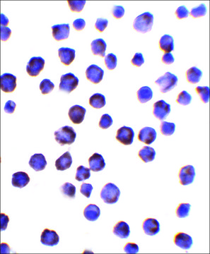 Anti-FOXD4L1 antibody produced in rabbit