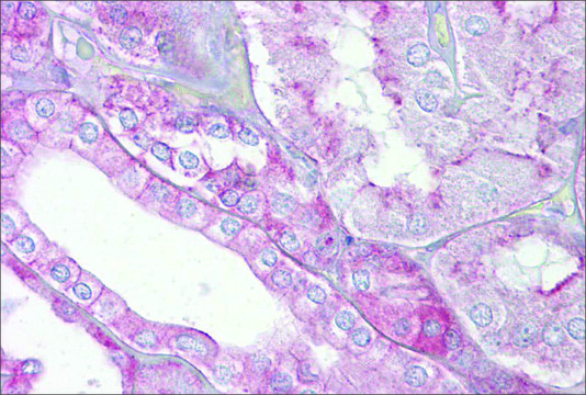 Anti-SPTAN1 antibody produced in rabbit