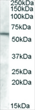 Anti-GCNT3 (AA 410-422) antibody produced