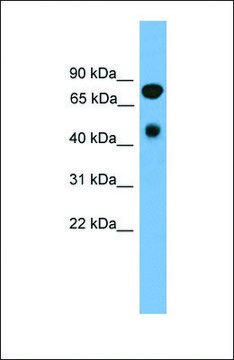 Anti-RIPK4, (N-terminal) antibody produced in