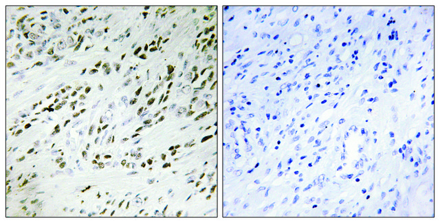 Anti-TSH2 antibody produced in rabbit