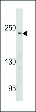 ANTI-PCM-1 (CENTER) antibody produced in