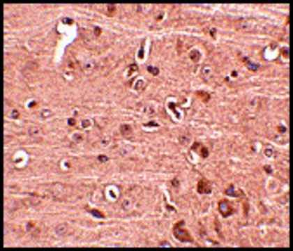 Anti-GLE1 (ab1) antibody produced in