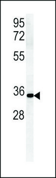 ANTI-ZDHC2 (N-TERMINAL) antibody produced in