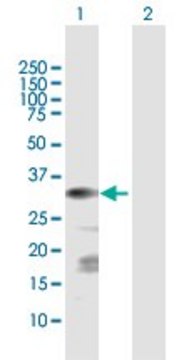 Anti-CSGALNACT1 antibody produced in rabbit
