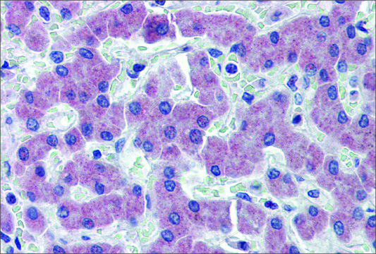 Anti-SLC27A2 antibody produced in rabbit