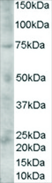 Anti-Silver Homologue/PMEL 17 antibody produced
