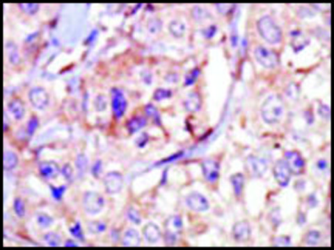 Anti-Haspin GSG2 (center) antibody produced