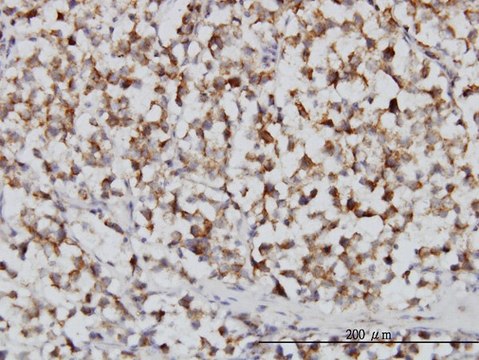Monoclonal Anti-FH, (C-terminal) antibody produced